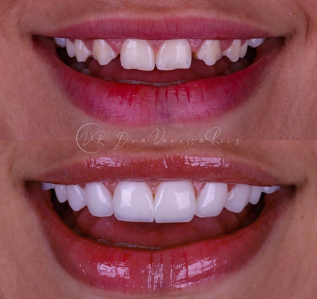 photo_5170398175318616758_y