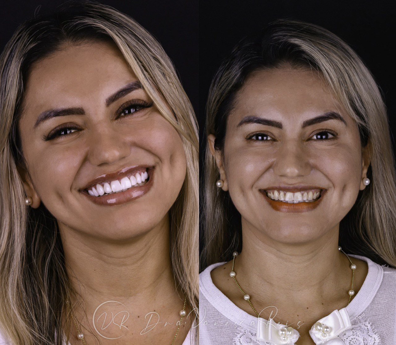 photo_5170398175318616760_y